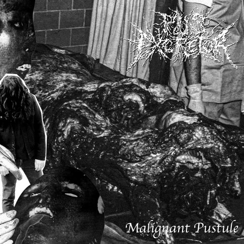 Pus_Excretor-Malignant_Pustule-EP-24BIT-WEB-FLAC-2025-MOONBLOOD.jpg